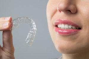 Invisalign for the Holidays Gainesville GA