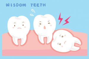 Wisdom Teeth Oakwood GA