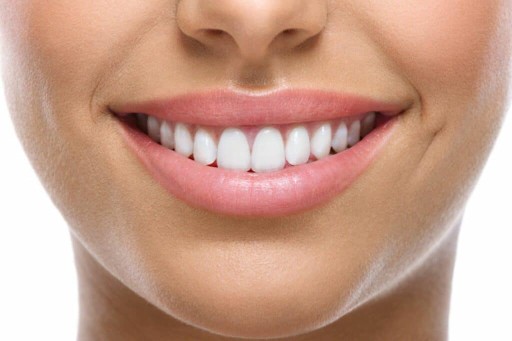 Which Is Better for Teens: Braces or Invisalign? Sosebee & Britt Orthodontics in Gainesville, GA
